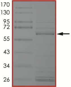 Sino Biological&nbsp;Recombinant Human BRAF/B-Raf Protein (d486-490, V471F, GST Tag)